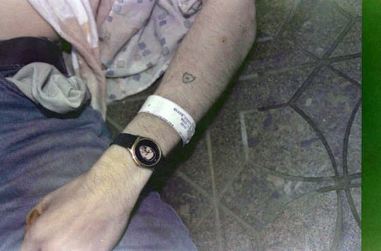 Brazo del cadáver de Cobain con el brazalete de identificación del centro de desintoxicación del que acababa de salir.